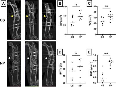 rhBMP-2-loaded hydroxyapatite/beta-tricalcium phosphate microsphere/hydrogel composite promotes bone regeneration in a novel rat femoral nonunion model